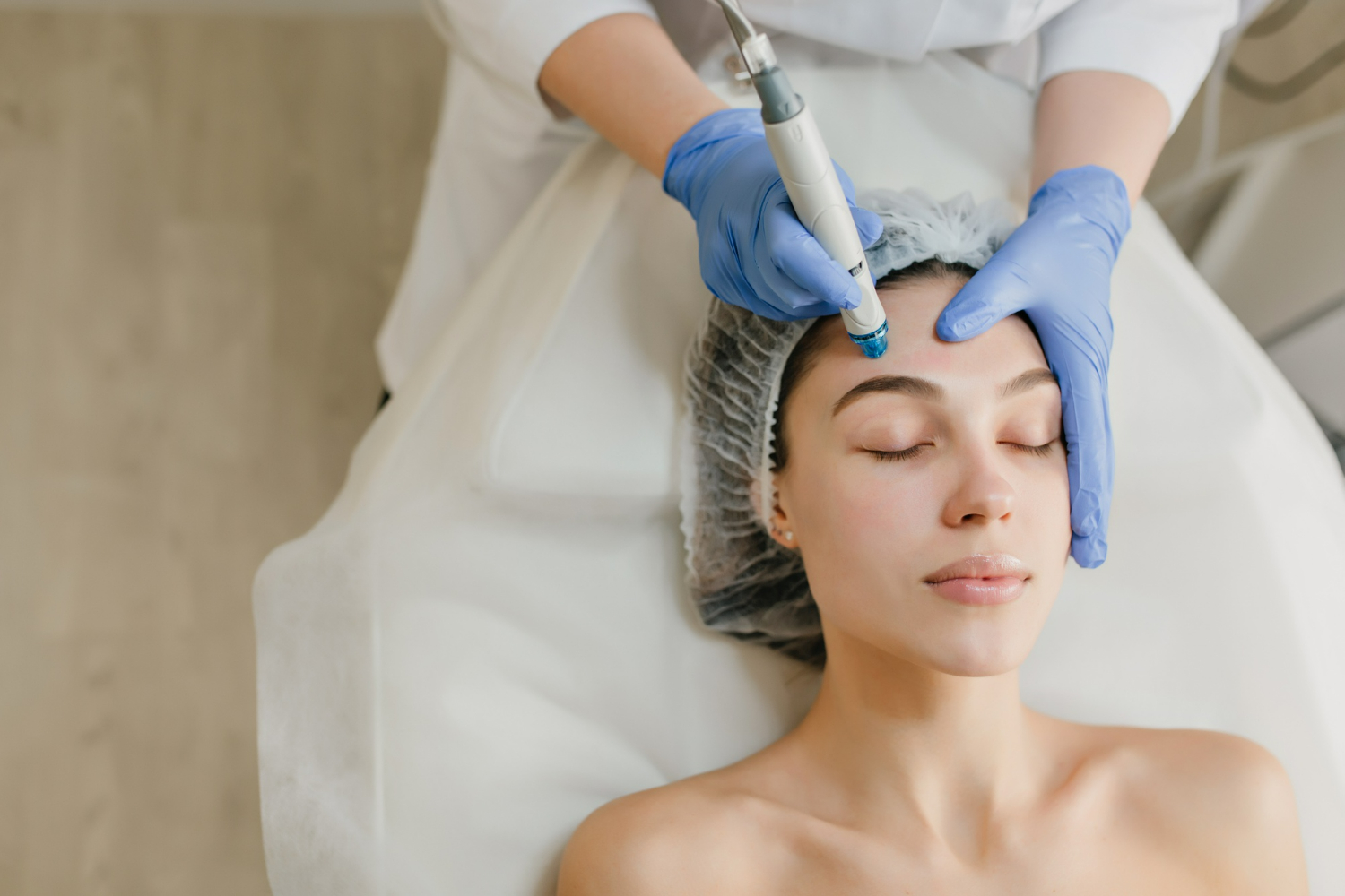 microneedling-almendralejo